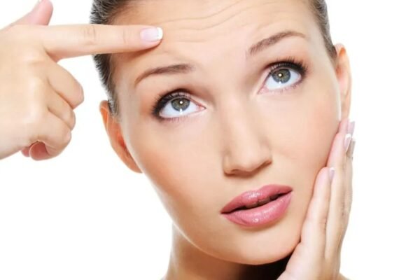 Reducing the Appearance of Fine Lines